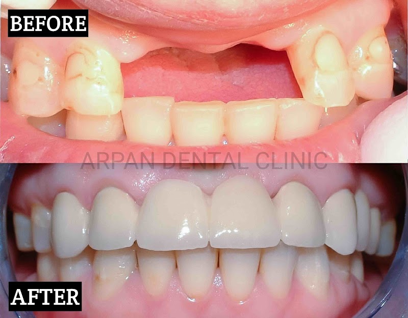 ARPAN DENTAL CLINIC