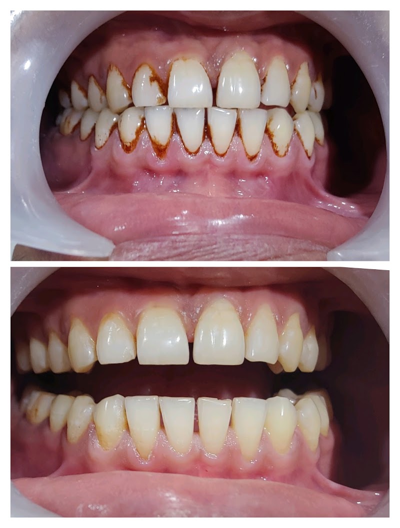 Dental Clinic At Lakshdeep Hospital