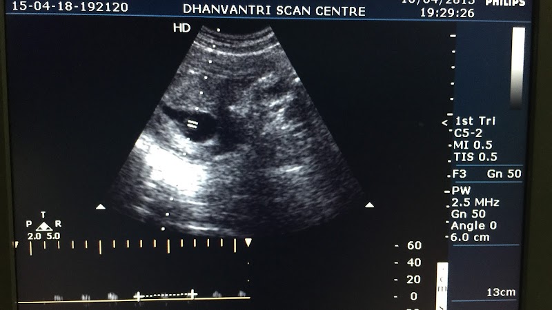 Dhanvantri Scan Center