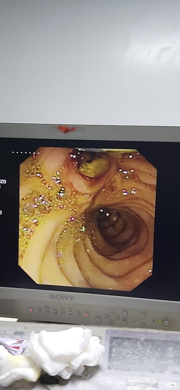 Dr. Netaji Garad - Gastroenterologist in Devendra Nagar, Raipur