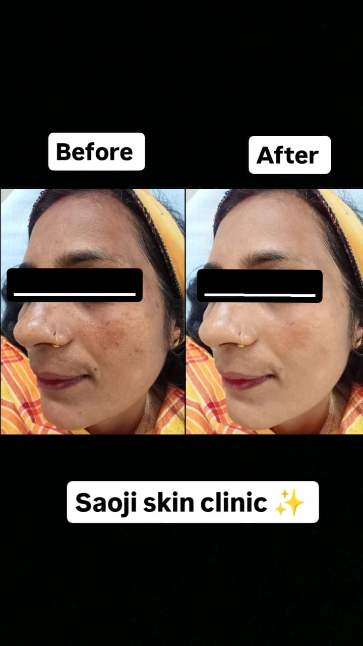 Dr. Ritu Saoji